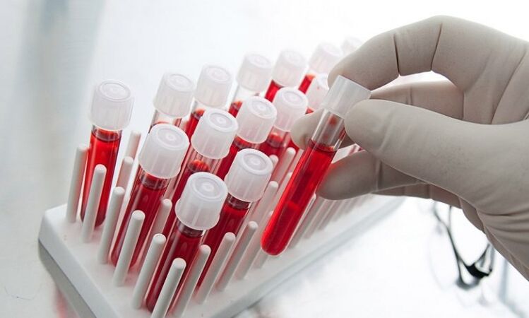 sangre en tubos de ensayo para el análisis de un perro con prostatitis