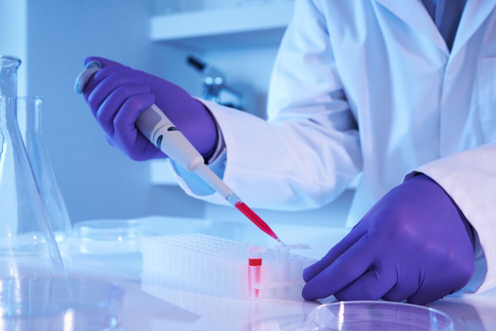 análisis de sangre para diagnosticar la prostatitis bacteriana crónica
