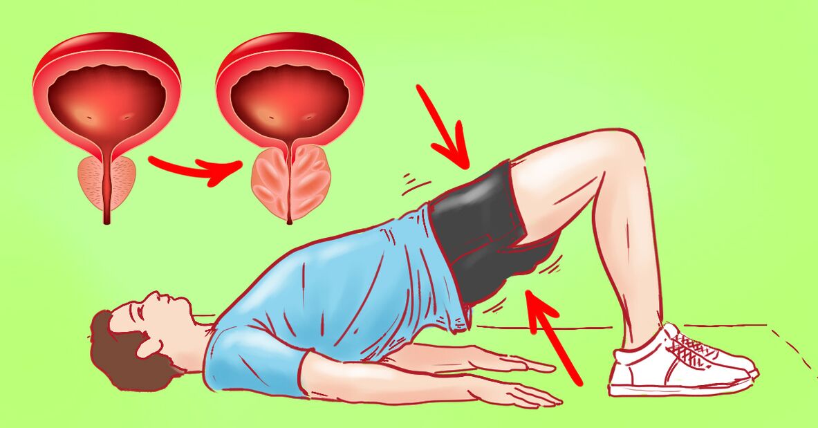 la esencia del ejercicio para la prostatitis