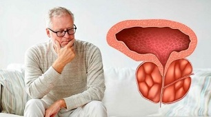 causas de la prostatitis bacteriana en los hombres